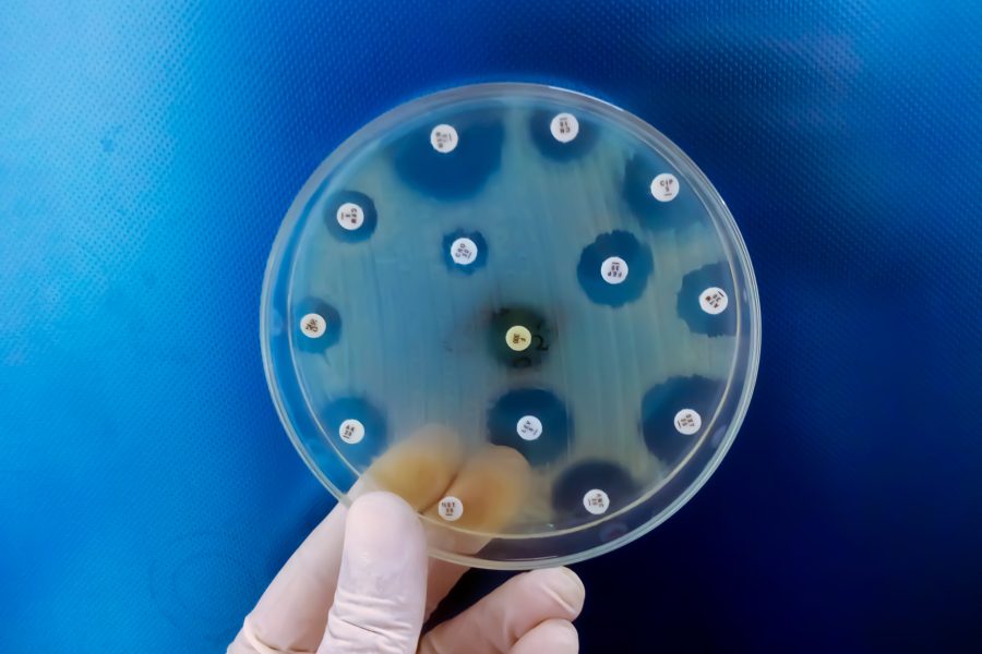 hand-holding-culture-plate-bacterial-growth-showing-antibiotic-sensitivity-their-colony (1)