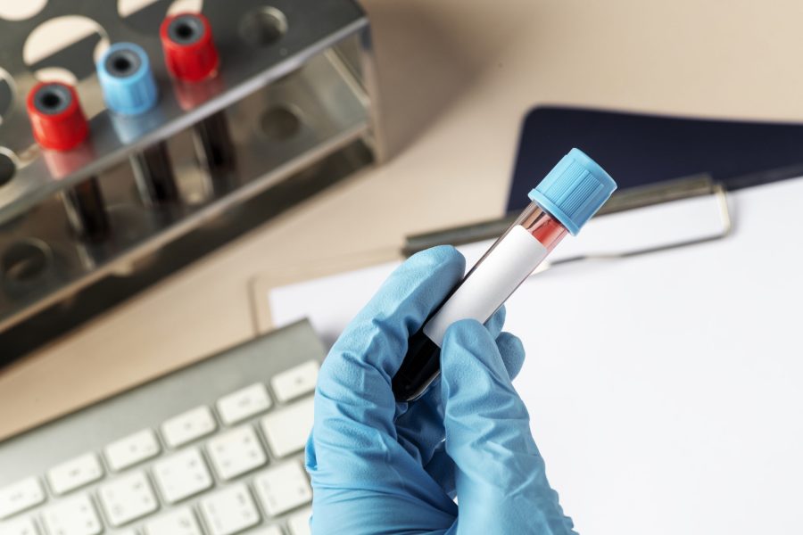 Surgeon holding a blood test